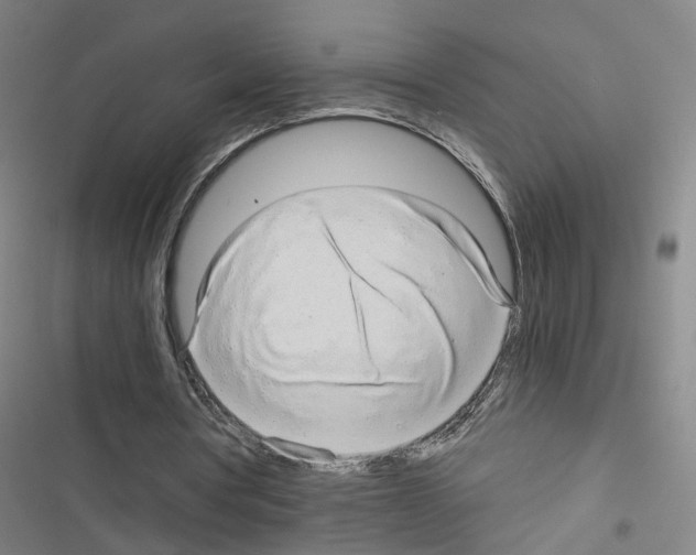 X0000116640386201001251140