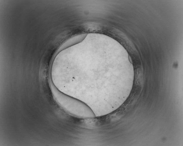 X0000116640417201001251140