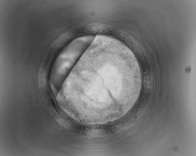 X0000116640593201001251137