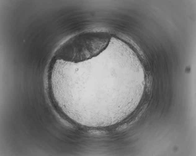 X0000116640629201001251136