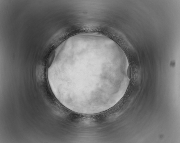 X0000116640696201001251136