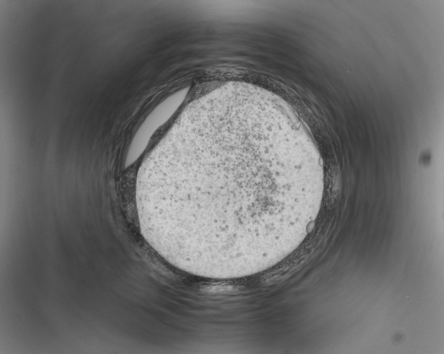 X0000116640759201001251136