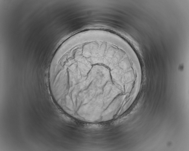 X0000116640945201001251133