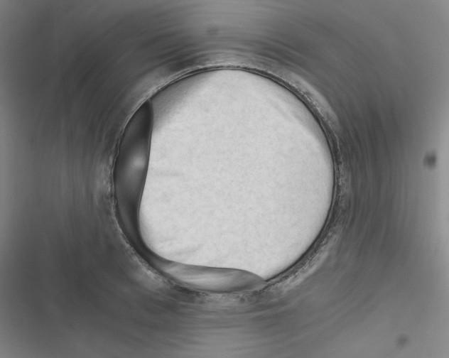 X0000116640993201001251132