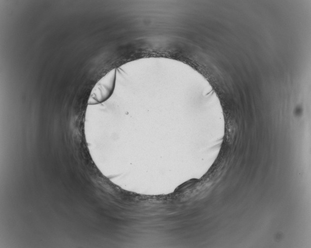 X0000116641010201001251131