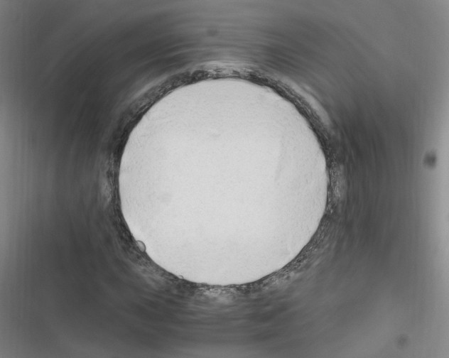 X0000116641015201001251131