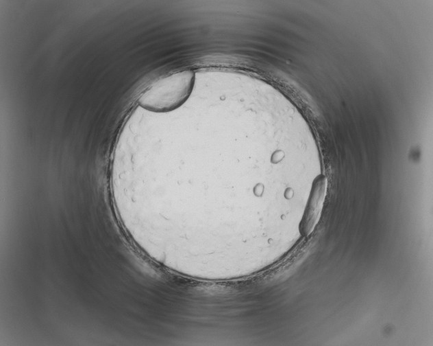 X0000116641033201001251131