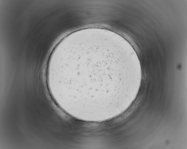 X0000116641054201001251132