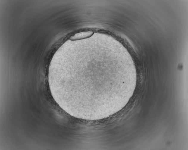 X0000116641064201001251131