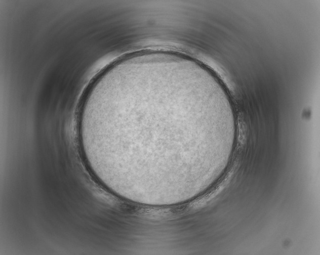 X0000116641074201001251131