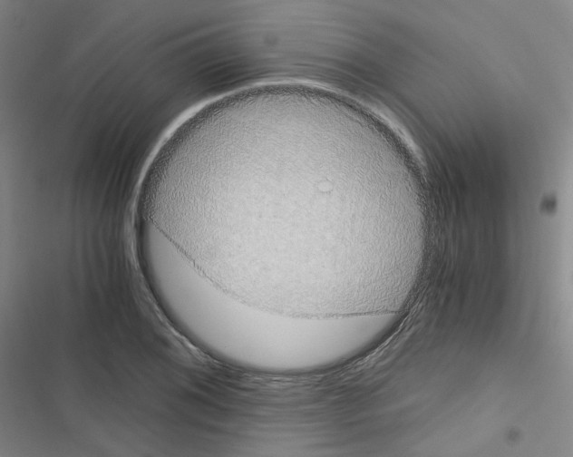 X0000116641076201001251131