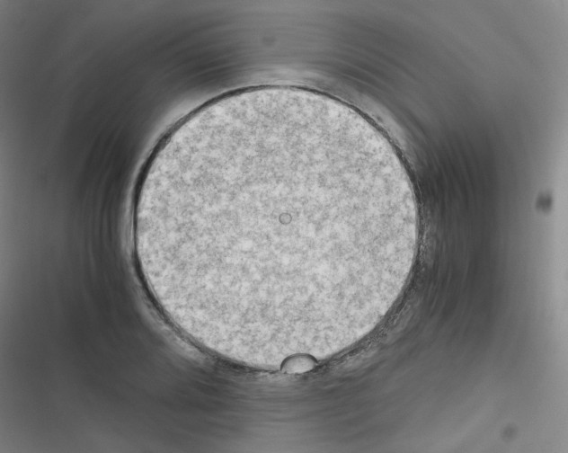 X0000116641080201001251131