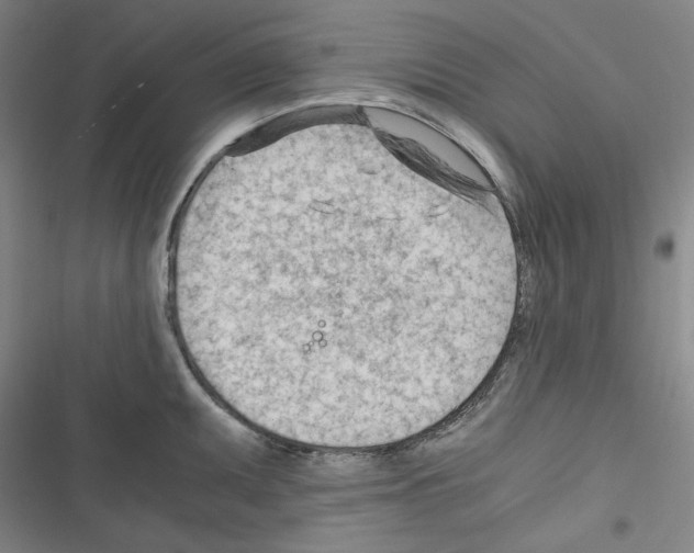 X0000116641095201001251131