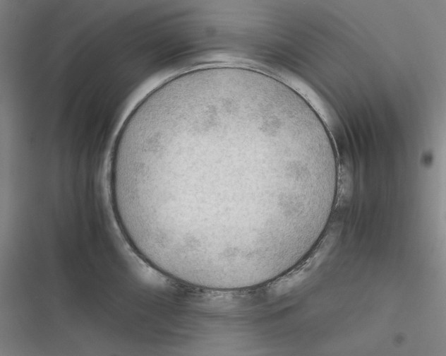 X0000116641098201001251131