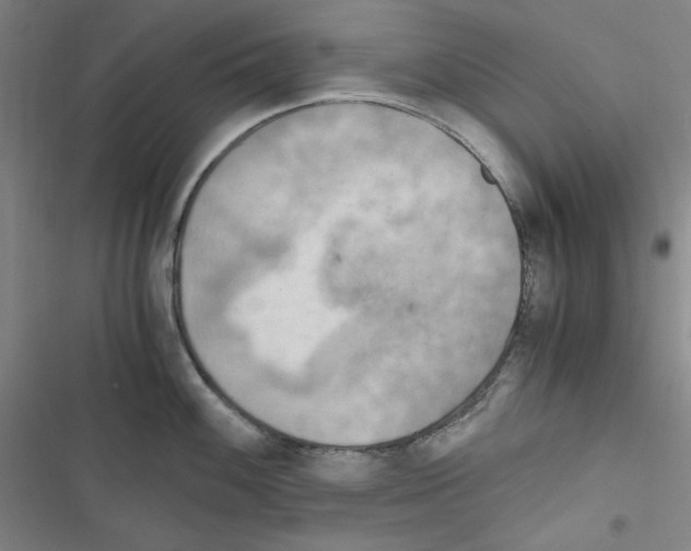 X0000116641100201001251131