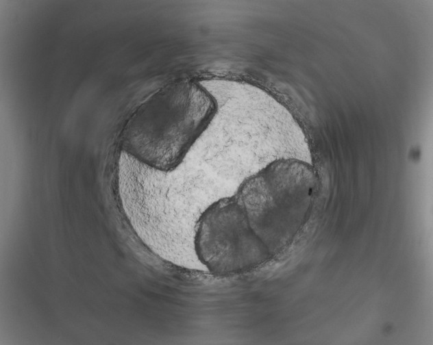 X0000116641105201001251130