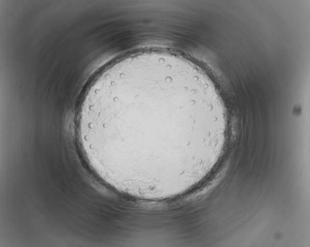 X0000116641113201001251130