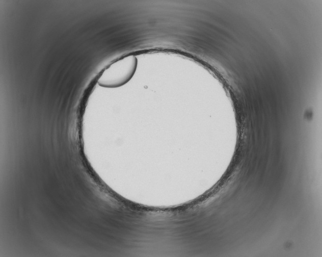 X0000116641118201001251130