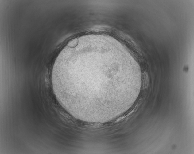 X0000116641158201001251130