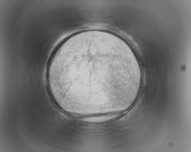 X0000116641174201001251130