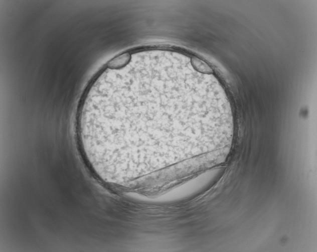 X0000116641279201001251128