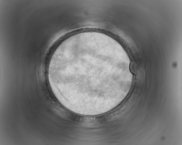 X0000116641310201001251127