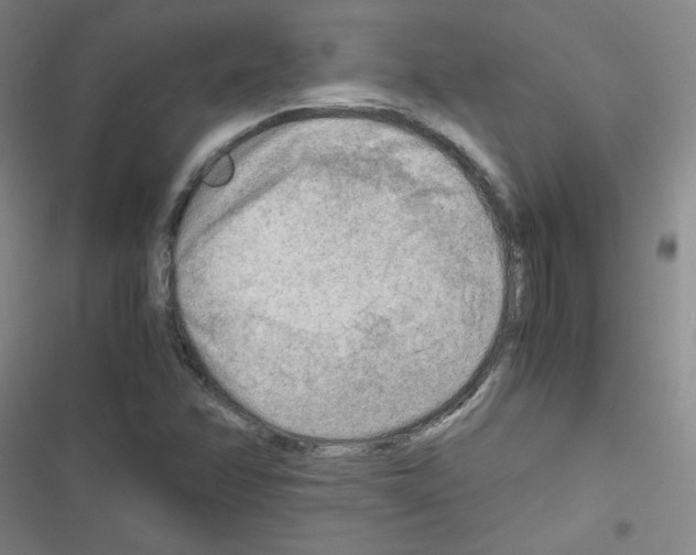 X0000116641358201001251127