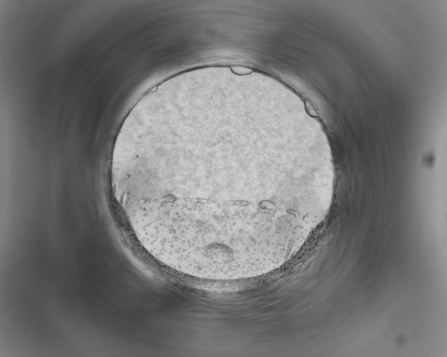 X0000116641383201001251127