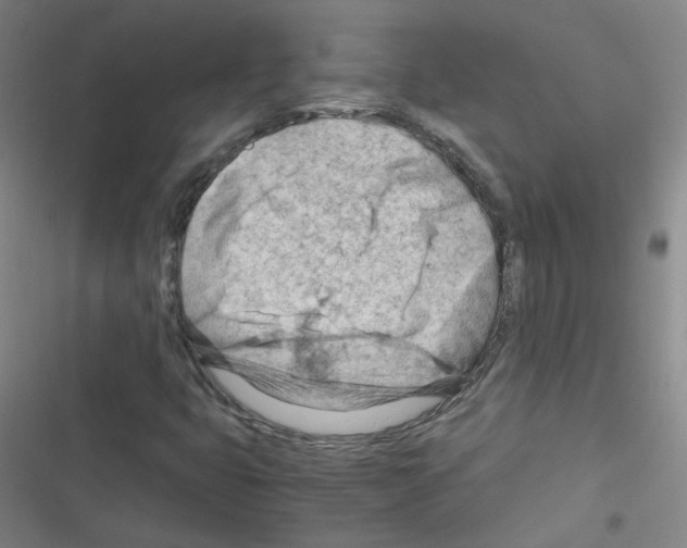 X0000116641399201001251126