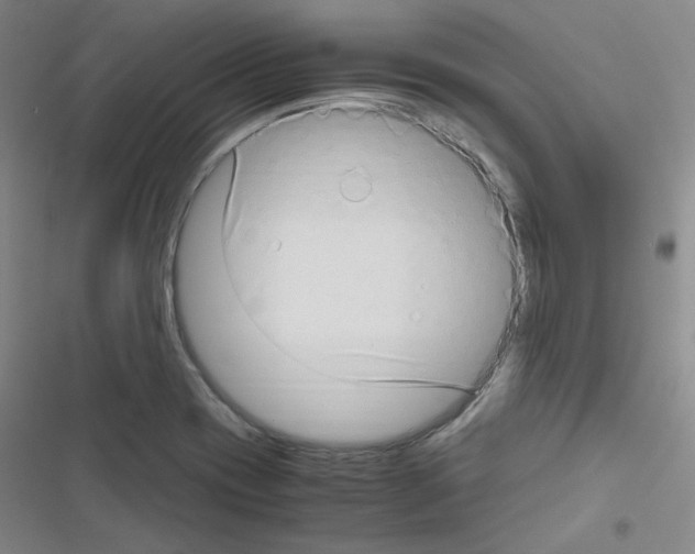 X0000116641417201001251126