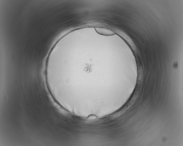 X0000116641439201001251127