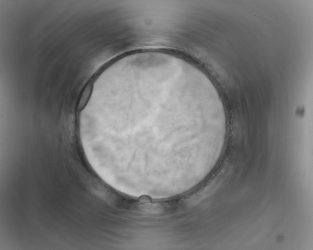 X0000116641457201001251126