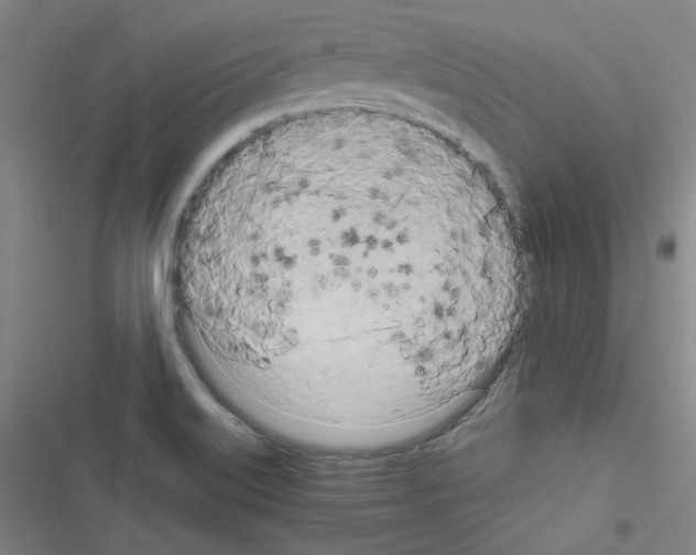 X0000116641515201001251125