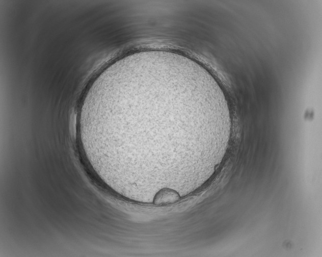 X0000116650014201001111238