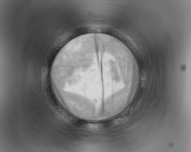 X0000116650314201001111234