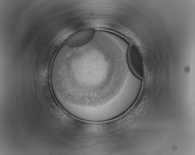 X0000116650785201001111228