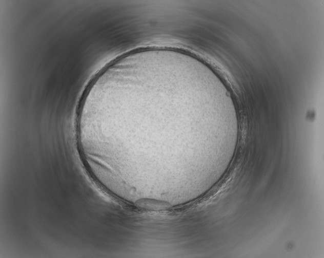 X0000116650990201001111225