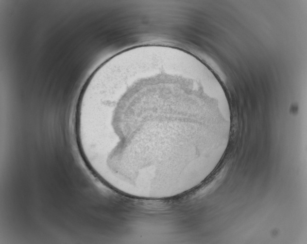 X0000116651007201001111225