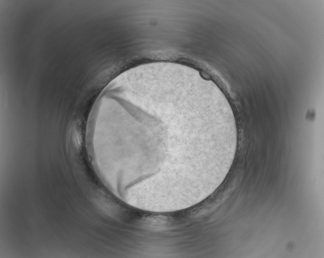X0000116650069201001251205