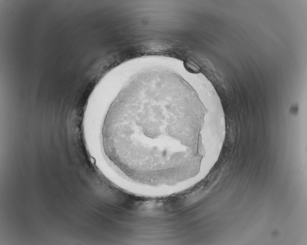 X0000116650366201001251202