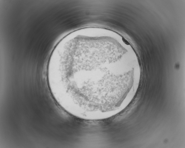 X0000116650862201001251155
