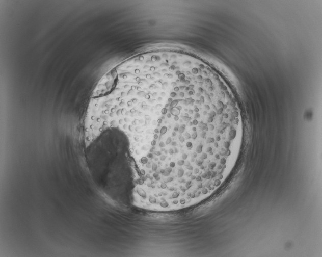 X0000116650953201001251154