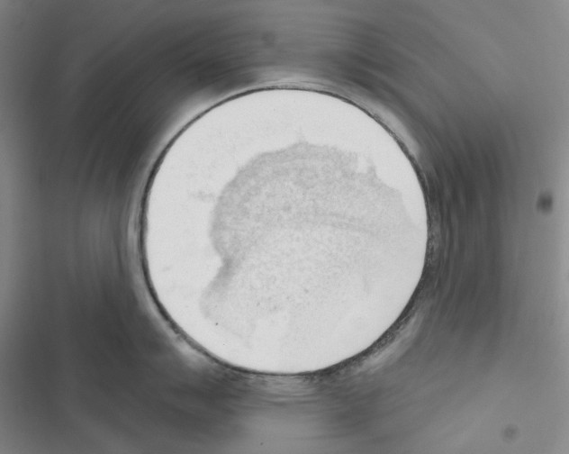 X0000116651007201001251153