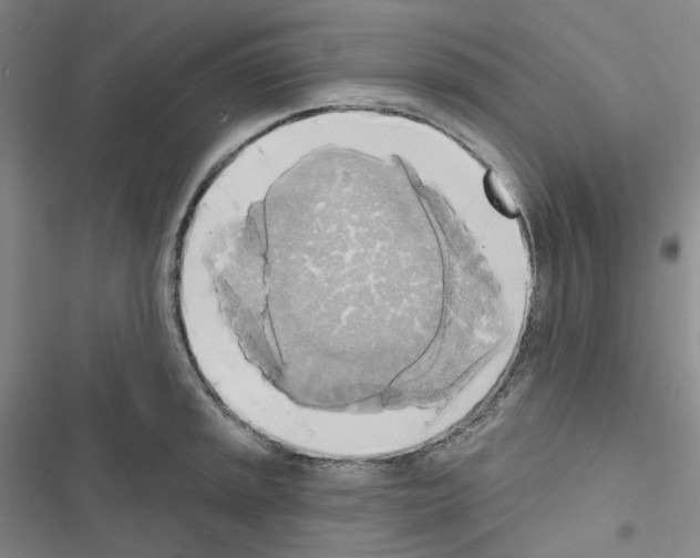 X0000116651045201001251153