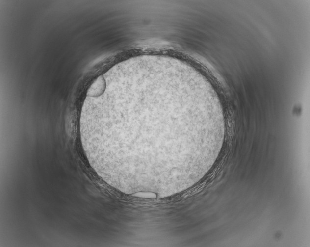 X0000116651063201001251152