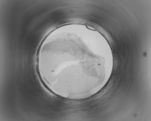 X0000116651095201001251152