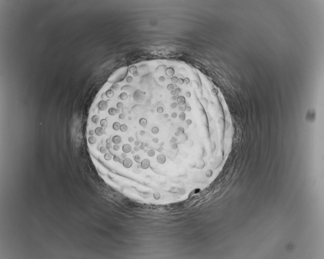 X0000116651106201001251151
