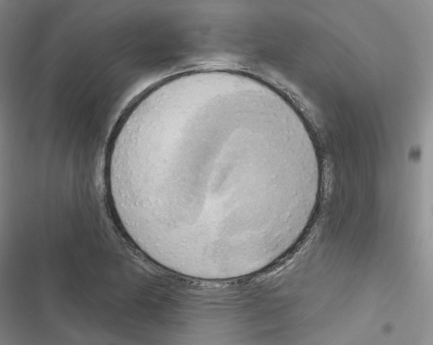 X0000116651174201001251150