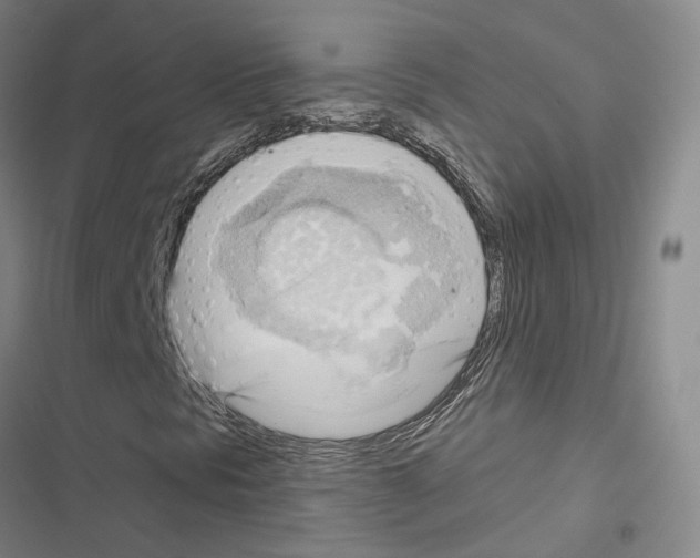 X0000116651297201001251148
