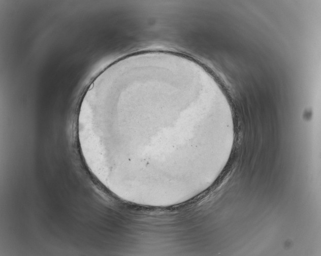 X0000116651367201001251148